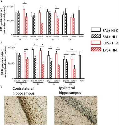 N-Acetyl Cysteine Restores Sirtuin-6 and Decreases HMGB1 Release Following Lipopolysaccharide-Sensitized Hypoxic-Ischemic Brain Injury in Neonatal Mice